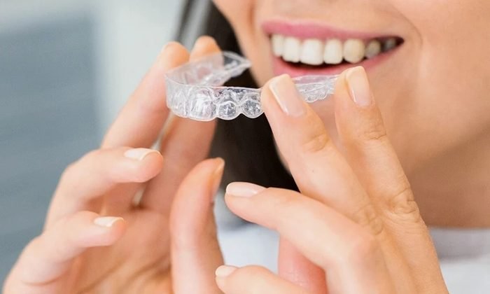 Tratamento ortodôntico na Click Dente